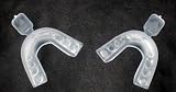 Pristine Teeth Whitening Mouth Trays