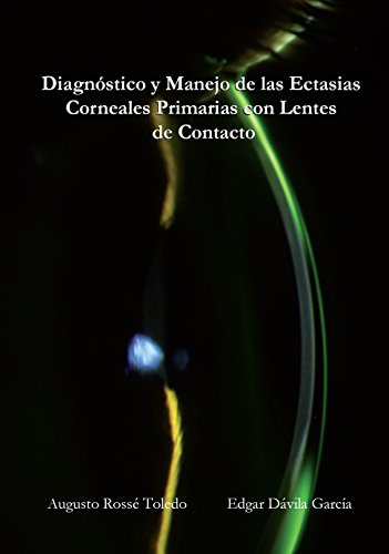 Diagnostico y Manejo de las Ectasias Corneales Primarias con Lentes de Contacto (Spanish Edition)