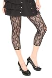 Black Lace Leggings