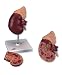 3B Scientific Kidney with Adrenal Gland