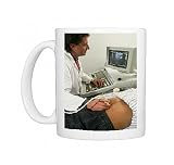 Doppler ultrasound examination of the prostate Photo Mugs