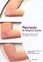Psoriasis: A Patient's Guide