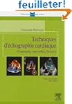 Techniques d'�cographie cardiaque