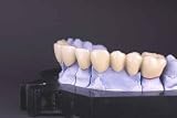 Dental Bridge - 18