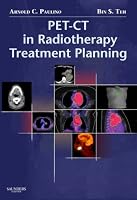 PET-CT in Radiotherapy Treatment Planning