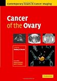 Cancer of the Ovary (Contemporary Issues in Cancer Imaging)