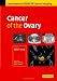 Cancer of the Ovary (Contemporary Issues in Cancer Imaging)