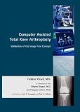 Computer Assisted Orthopaedics  The Image Free Concept in Total Knee Arthroplasty: Validation of the Image Free Concept