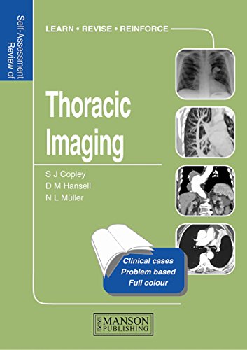 Thoracic Imaging: Self-Assessment Colour Review (Illustrated Clinical Cases)