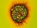 Hepatitis A Viruses X225,000 Photographic Poster Print, 16x12