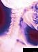 Colorized X-Ray Showing Normal Cervical Spine Lateral View Vertebrae C1-C7 Photograph...