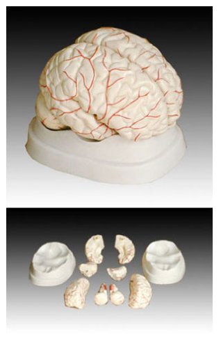 Childrens Toyshop  Toys : Scientific Anatomical Model : Anatomical Human Brain Model With Arteries