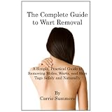 The Complete Guide to Wart Removal: A Simple, Practical Guide to Removing Moles, Warts, and Skin Tags Safely and Naturally