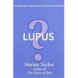 lupus an alternative approach to an autoimmune disease