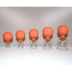 Schr�pfgl�ser Schr�pfglas 5 im Set 25mm - 65mm zum feuerlosen Schr�pfen Duranglas
