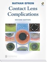 Contact Lens Complications, 2e