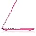 Kuzy - Lace Rubberized Hard Case for Older MacBook Pro 15.4 inch with Retina Display A1398 15 inch Plastic Shell Cover - Lace Neon Pink