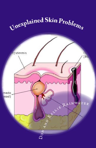 Unexplained Skin Problems: Home Treatment And Precautions