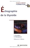Echographie de la thyro�de
