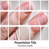Wound Healing Powerpoint Template - Wound Healing Powerpoint (PPT) Presentation