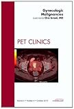 Gynecologic malignancies