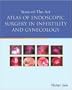 State of the Art Atlas of Endoscopic Surgery in Infertility and Gynecology