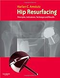 Hip resurfacing : principles, indications, technique and results