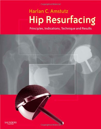 hip resurfacing principles indications technique and results book and dvd 1e