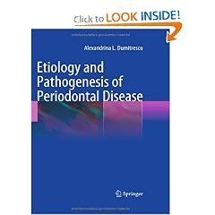 Etiology and Pathogenesis of Periodontal Disease by Alexandrina L. Dumitrescu