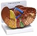 Anatomical Human Liver Diseased Cancer Model