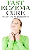 Eczema Cure - The Easiest, Safest Way To Cure Eczema Fast (Eczema Treatment, Eczema Remedies, Eczema Treatments)