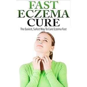 Eczema Cure - The Easiest, Safest Way To Cure Eczema Fast (Eczema Treatment, Eczema Remedies, Eczema Treatments)