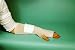 Search : Mt Spandage Tubular Elastic Dressing Retainer 4/Large Hand/Arm/Leg/Foot
