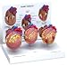 3 Piece Mini Heart Disease Anatomical Model #2550