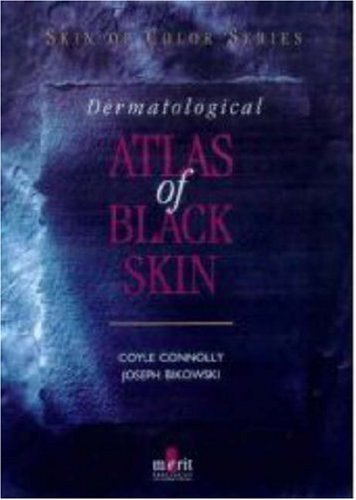 dermatological atlas of black skin skin of color series skin of colour