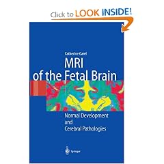 MRI of the Fetal Brain: Normal Development and Cerebral Pathologies by C. Garel, V. Delezoide, A.-L. Delezoide and L. Guibaud