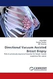Directional Vacuum Assisted Breast Biopsy: Role in previously equivocal biopsies for breast masses suspicious for cancer