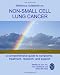 Medifocus Guidebook on: Non-Small Cell Lung Cancer 41wt2zI3u1L. SL75 Stop Smoking And Improve Your Health In 20 Minutes
