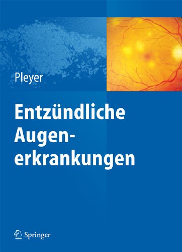 Entzündliche Augenerkrankungen (German Edition)