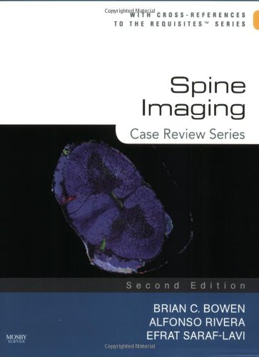 Spine Imaging: Case Review Series