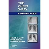 the chest x ray a survival guide 1e
