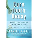 Cure Tooth Decay: Remineralize Cavities and Repair Your Teeth Naturally with Good Foodby Ramiel Nagel