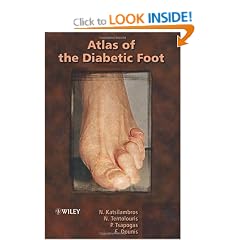 Atlas of the Diabetic Foot