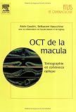 OCT de la macula