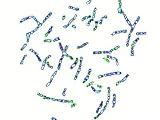 Human Chromosomes Changed to Z087-N-761 Photographic Poster Print, 40x30
