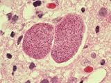 Toxoplasma Gondii, H&E Stain/252X Art Photographic Poster Print by G. W. Willis, 24x18