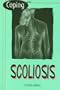 Coping with Scoliosis