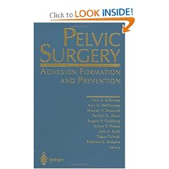 Pelvic Surgery: Adhesion Formation and Prevention by Gere S. DiZerega, Alan H. DeCherney, Michael P. Diamond and Randall C. Dunn