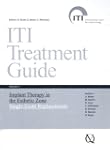 Iti Treatment Plan: Implant Therapy i...