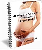 41xdEvfPWLL. SL160  40 Ways to Get Rid of or Prevent Stretch Marks,New Century Edition with DirectLink Technology